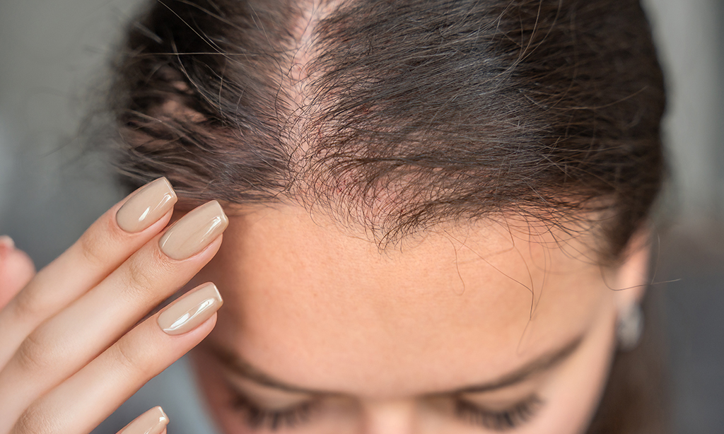 Haarausfall bei Frau, Inside Out Woman Beratung